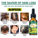 EELHOE 5 Days Hair Nutrient Solution Natural Essence - 30ml