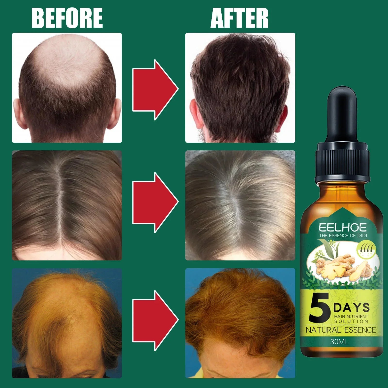 EELHOE 5 Days Hair Nutrient Solution Natural Essence - 30ml