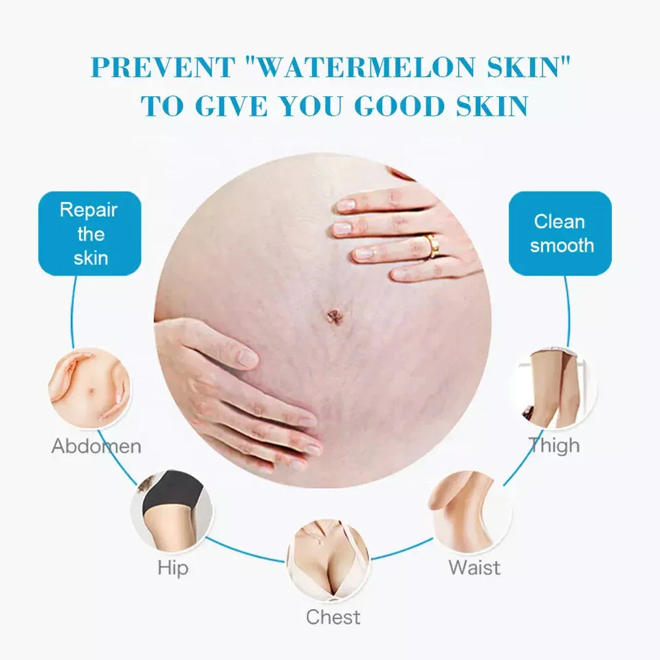 Aichun Beauty Anti-Stretch Mark Cream - 60g