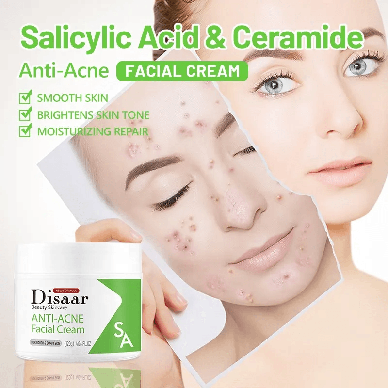 Disaar Beauty Anti-Acne Facial Cream - 120g