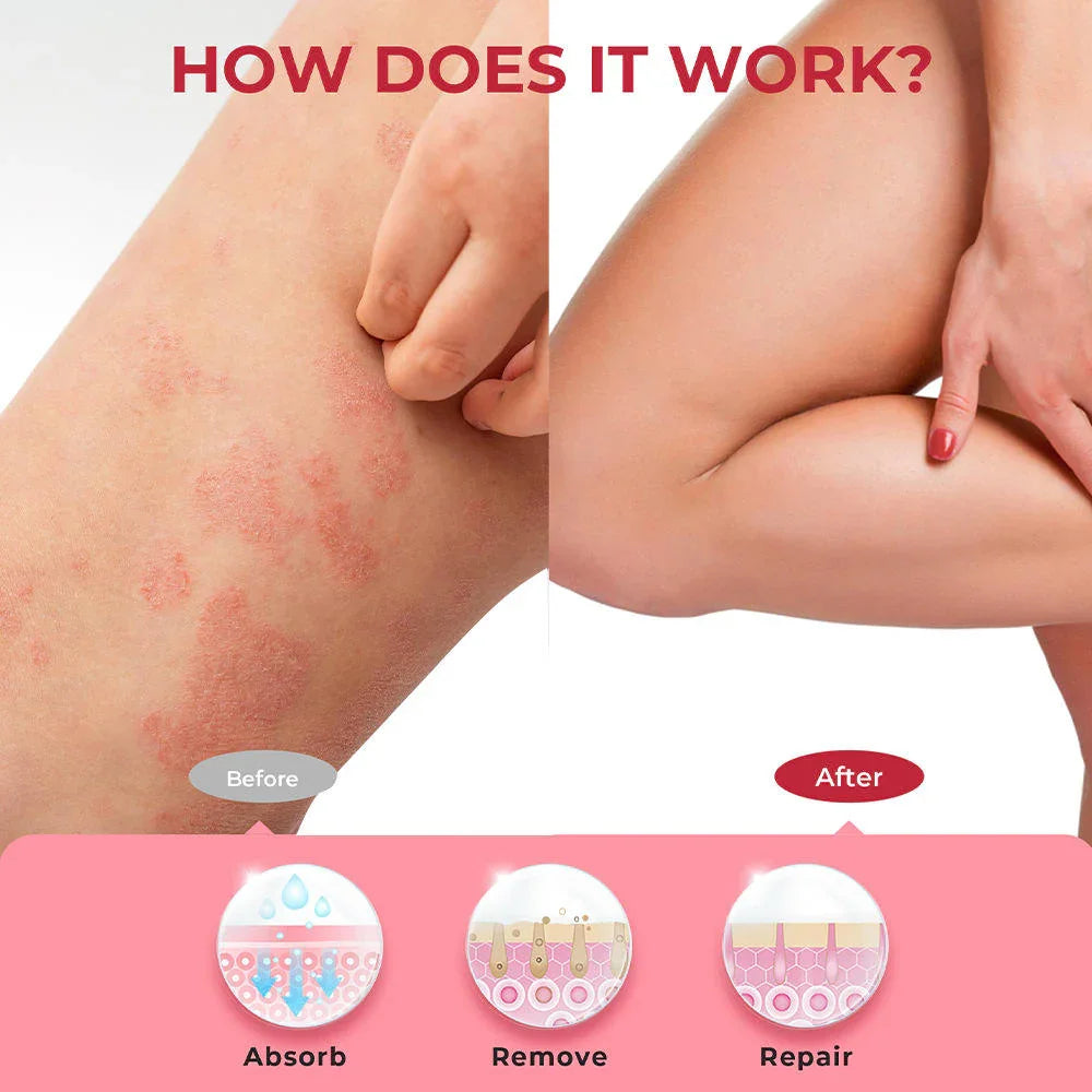 Sumifun Calamine Eczema Relief Cream - 20g
