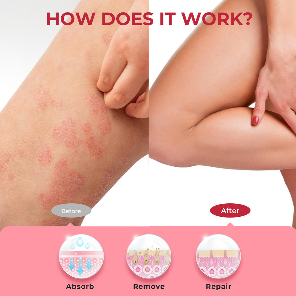 Sumifun Calamine Eczema Relief Cream - 20g