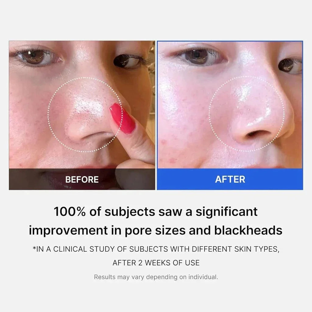 Medicube Zero Pore Pad Mild - 155g (70 Pads)