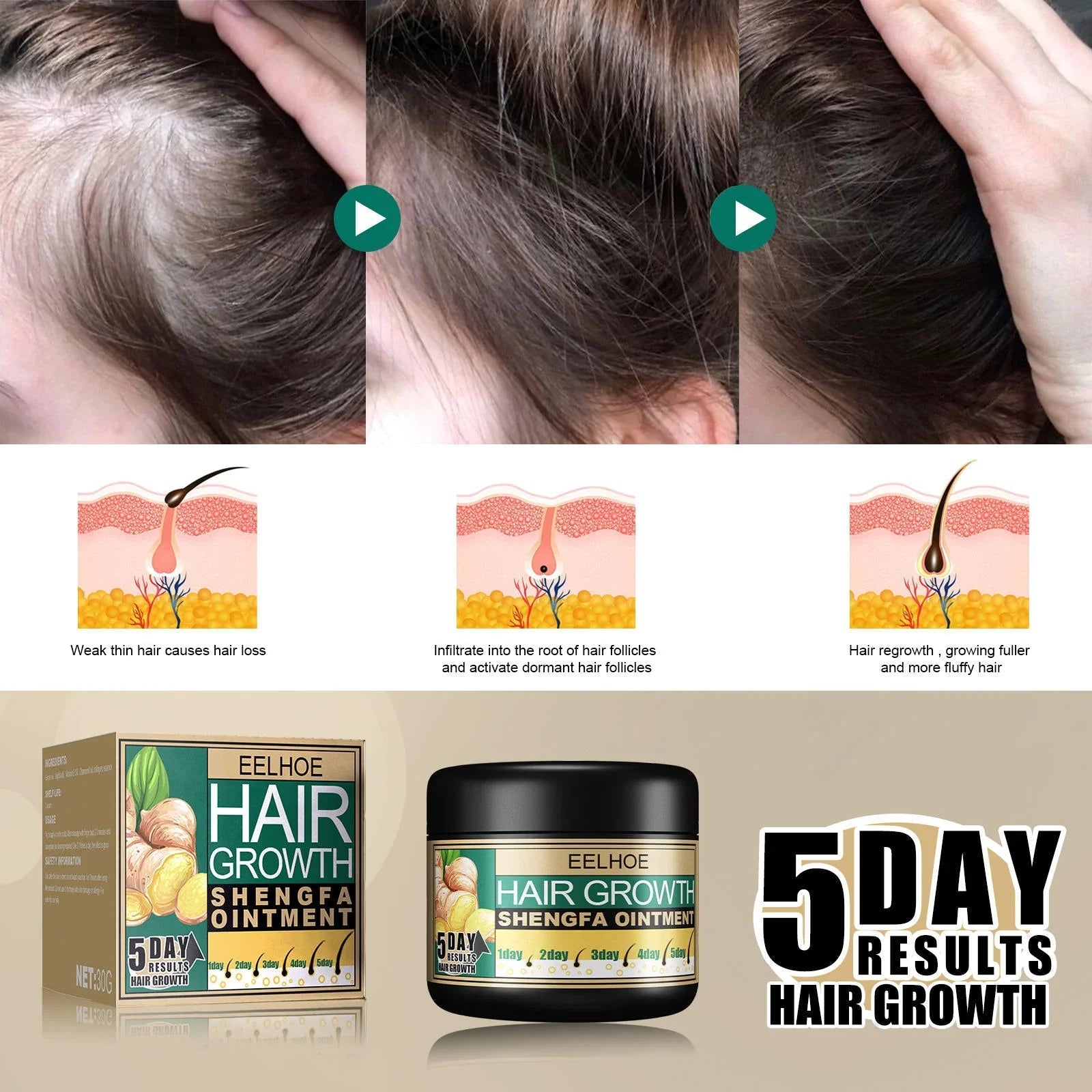 EELHOE Hair Growth Shengfa Cream - 100g