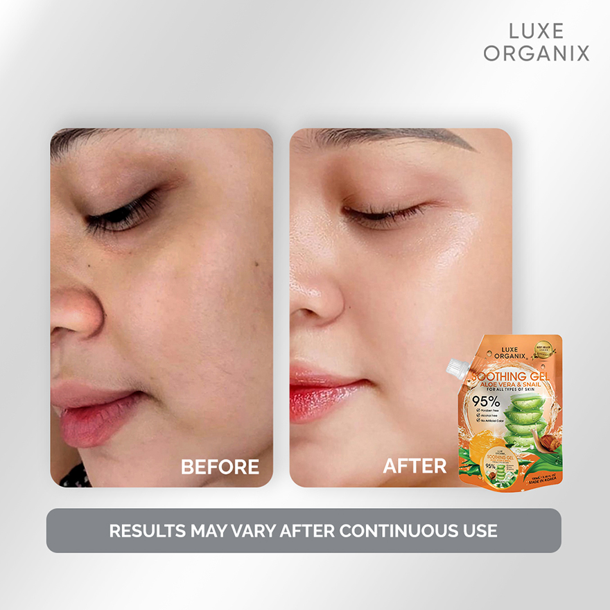 Luxe Organix Aloe Vera & Snail Soothing Gel - 100ml