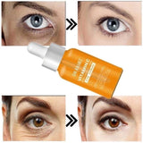 Dr. Rashel Vitamin C Brightening & Anti-Aging Eye Serum - 30ml - Pinoyhyper