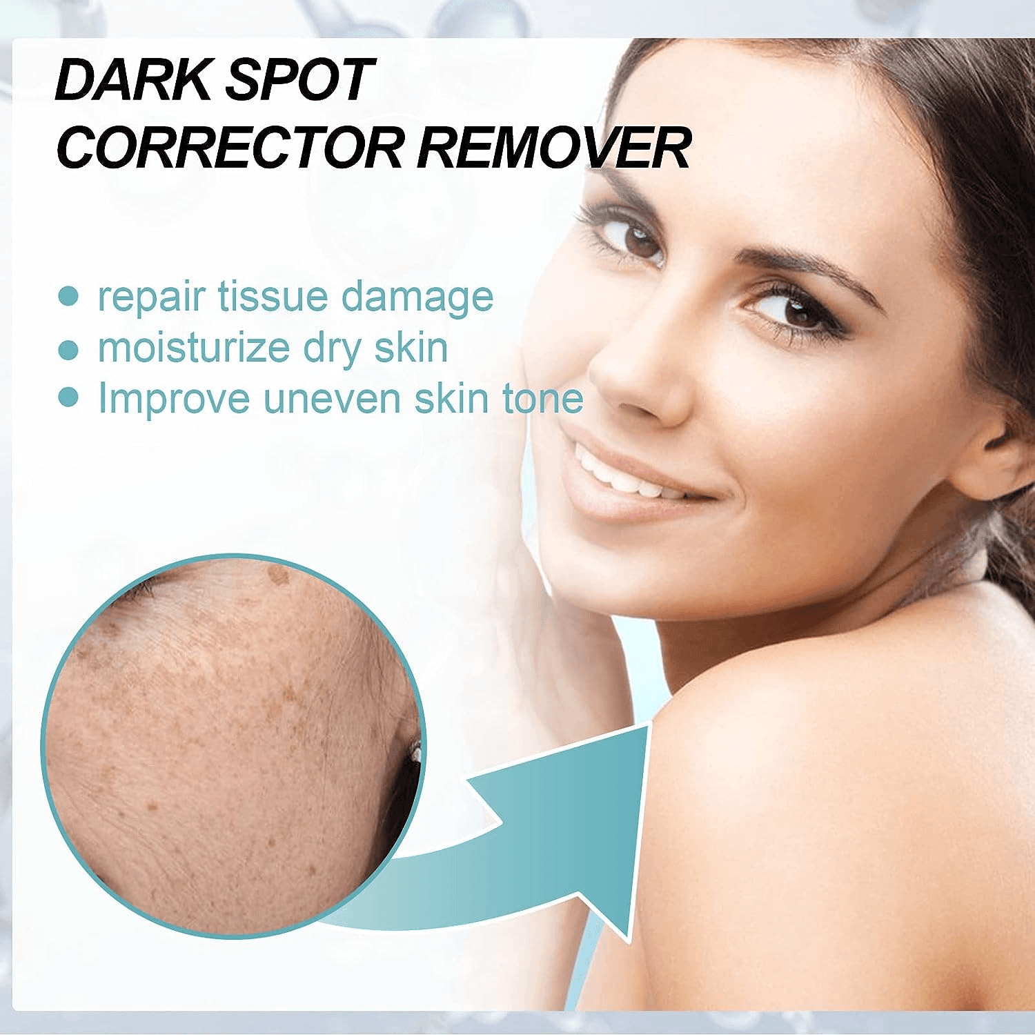 EELHOE Dark Spot Corrector - 30g - Pinoyhyper