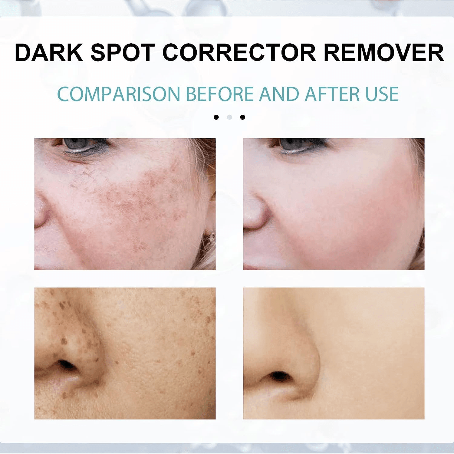 EELHOE Dark Spot Corrector - 30g - Pinoyhyper