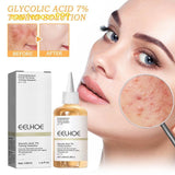 Eelhoe Glycolic Acid 7% Toning Solution - 100ml - Pinoyhyper