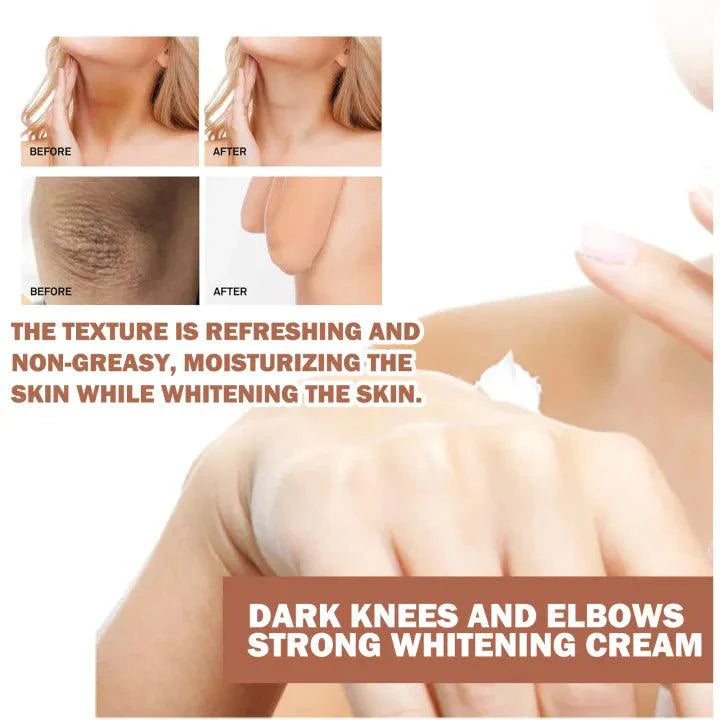 Eelhoe Knees and Elbows Whitening Cream - 50g - Pinoyhyper