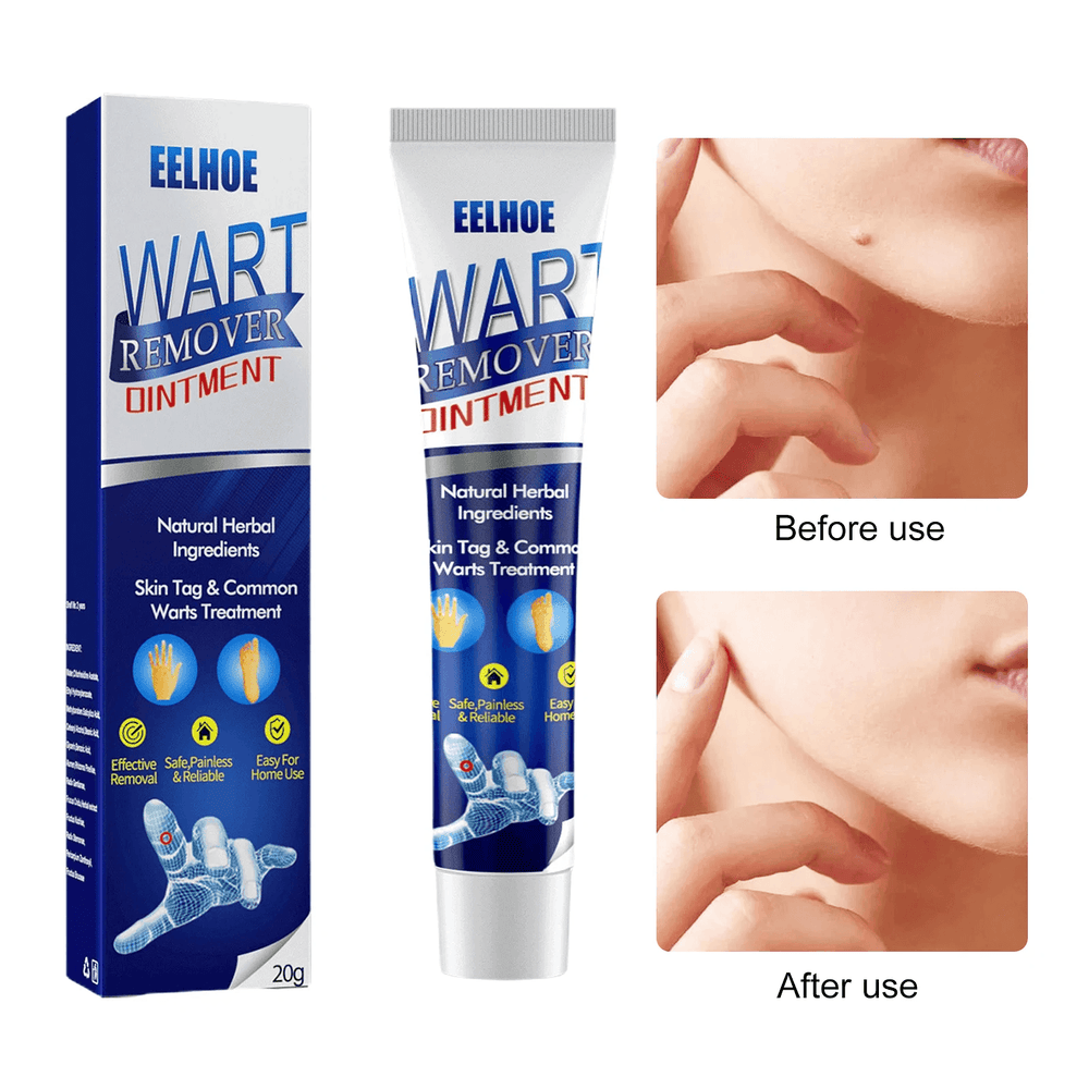 EELHOE Wart Remover Ointment - 20g - Pinoyhyper