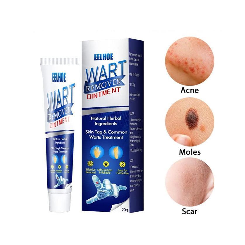 EELHOE Wart Remover Ointment - 20g - Pinoyhyper