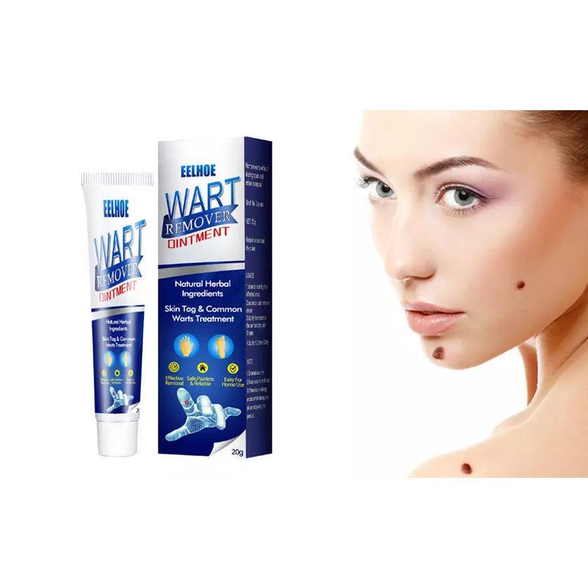 EELHOE Wart Remover Ointment - 20g - Pinoyhyper