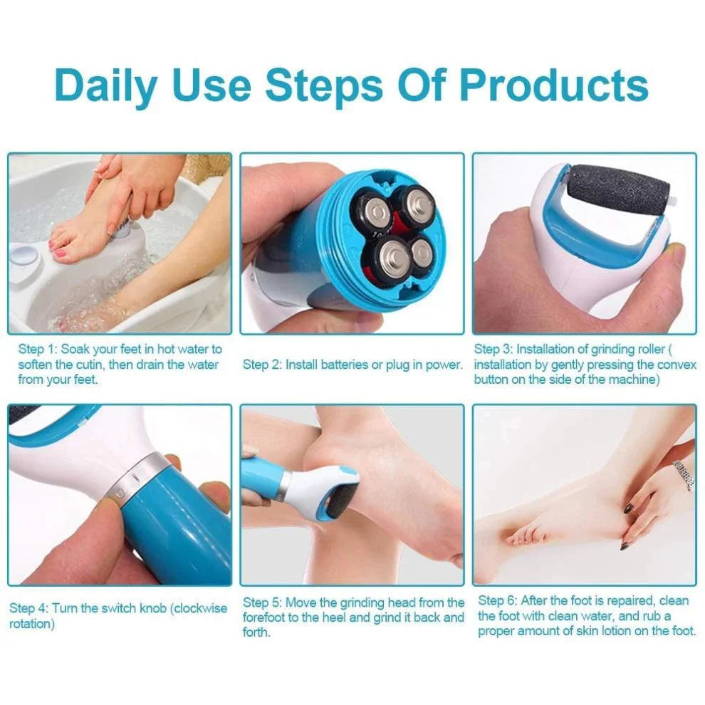 Electric Callus Remover Pedicure Tool - USB - Pinoyhyper