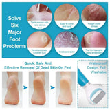 Electric Callus Remover Pedicure Tool - USB - Pinoyhyper