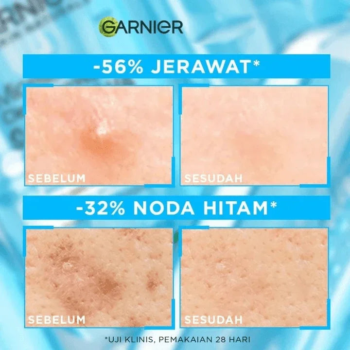 Garnier Micellar Salicyclic BHA Cleansing Water - 125ml - Pinoyhyper