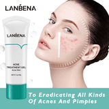 Lanbena Anti Acne Solution Gel - 20g - Pinoyhyper