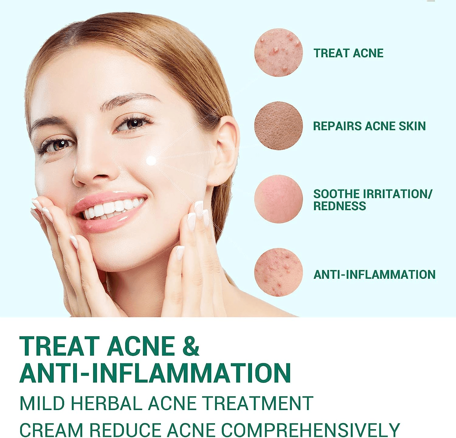 Lanbena Anti Acne Solution Gel - 20g - Pinoyhyper