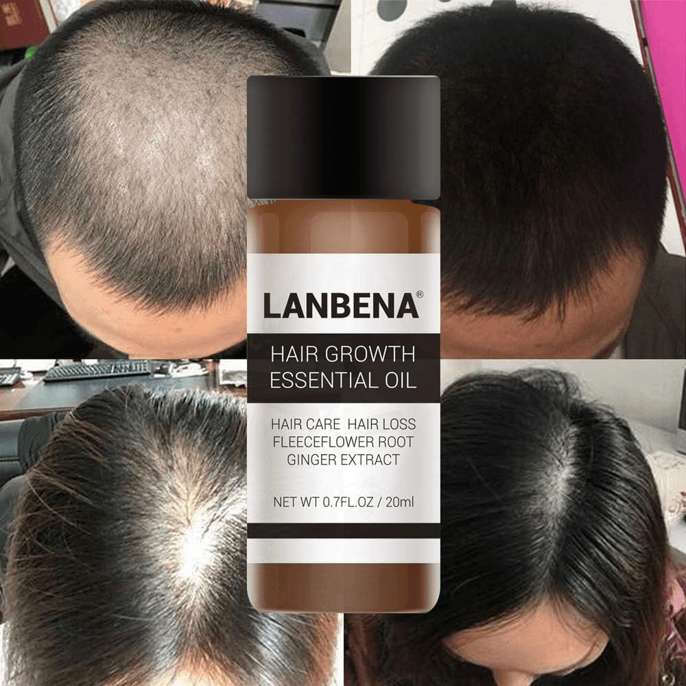 Lanbena Hair Nourishing Essential Oil - 20ml - Pinoyhyper