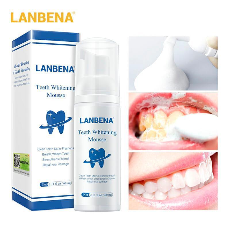 Lanbena Teeth Whitening Mousse - 60ml - Pinoyhyper