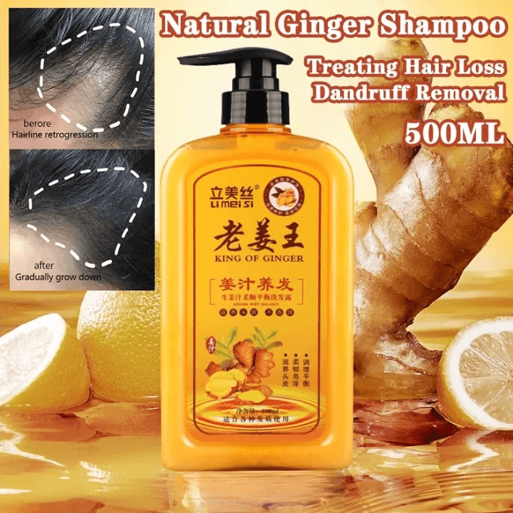 Li Mei Si King Of Ginger Shampoo - 500ml - Pinoyhyper