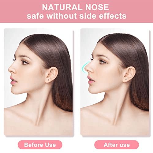 Rhino Plasty Nose Up Lifting Shaping Set Clipper - Pinoyhyper