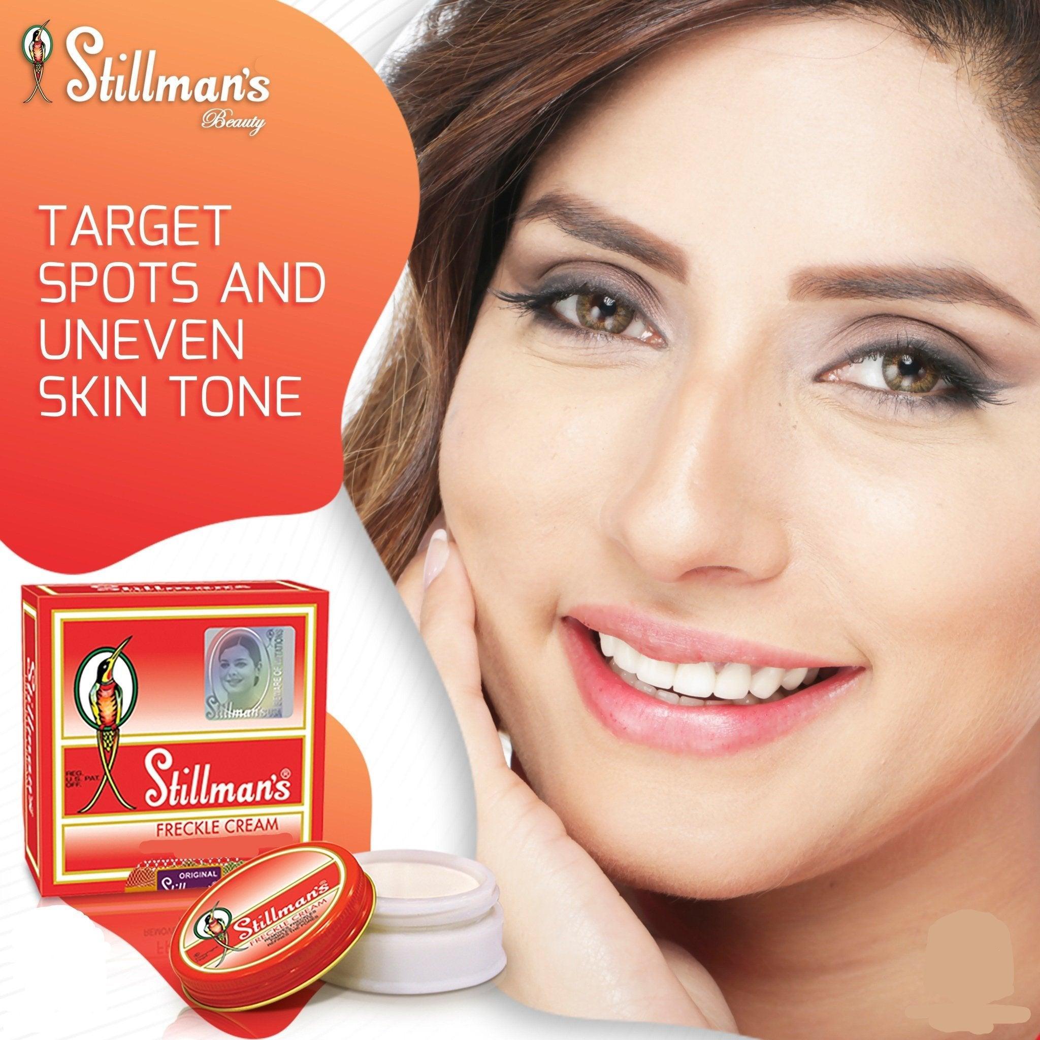 Stillman's Freckle Cream Removes Freckles - 28gm - Pinoyhyper