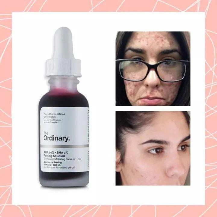 The Ordinary 3 IN 1 Vico Skin Care Peeling Solution Caffeine Solution & Niacinamide - 30ml - Pinoyhyper