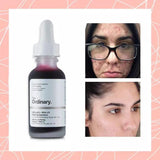 The Ordinary 3 IN 1 Vico Skin Care Peeling Solution Caffeine Solution & Niacinamide - 30ml - Pinoyhyper