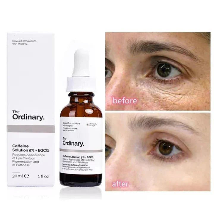 The Ordinary 3 IN 1 Vico Skin Care Peeling Solution Caffeine Solution & Niacinamide - 30ml - Pinoyhyper