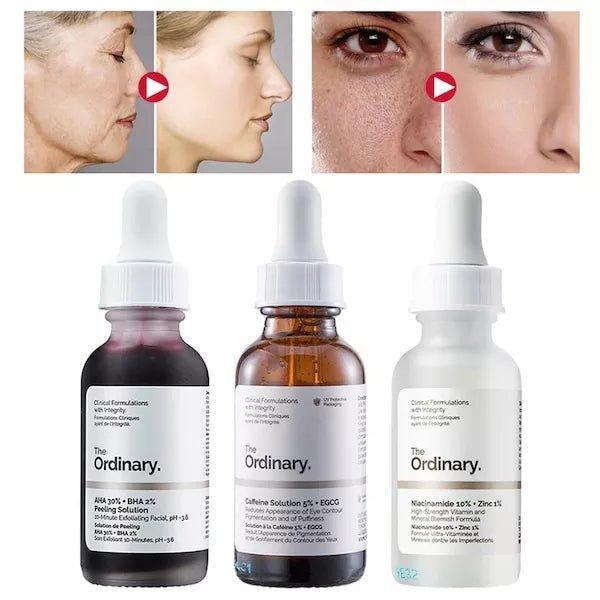 The Ordinary 3 IN 1 Vico Skin Care Peeling Solution Caffeine Solution & Niacinamide - 30ml - Pinoyhyper
