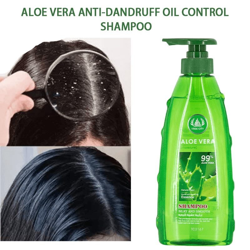 Tree City Aloe Vera Anti Dandruff Shampoo - 500ml - Pinoyhyper