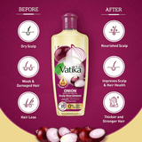 Vatika Naturals Onion Enriched Hair Oil - 300ml - Pinoyhyper