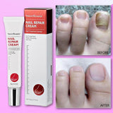 Vibrant Glamour Nail Repair Cream Anti Fungal Nails Repair Nourishing- 20g - Pinoyhyper